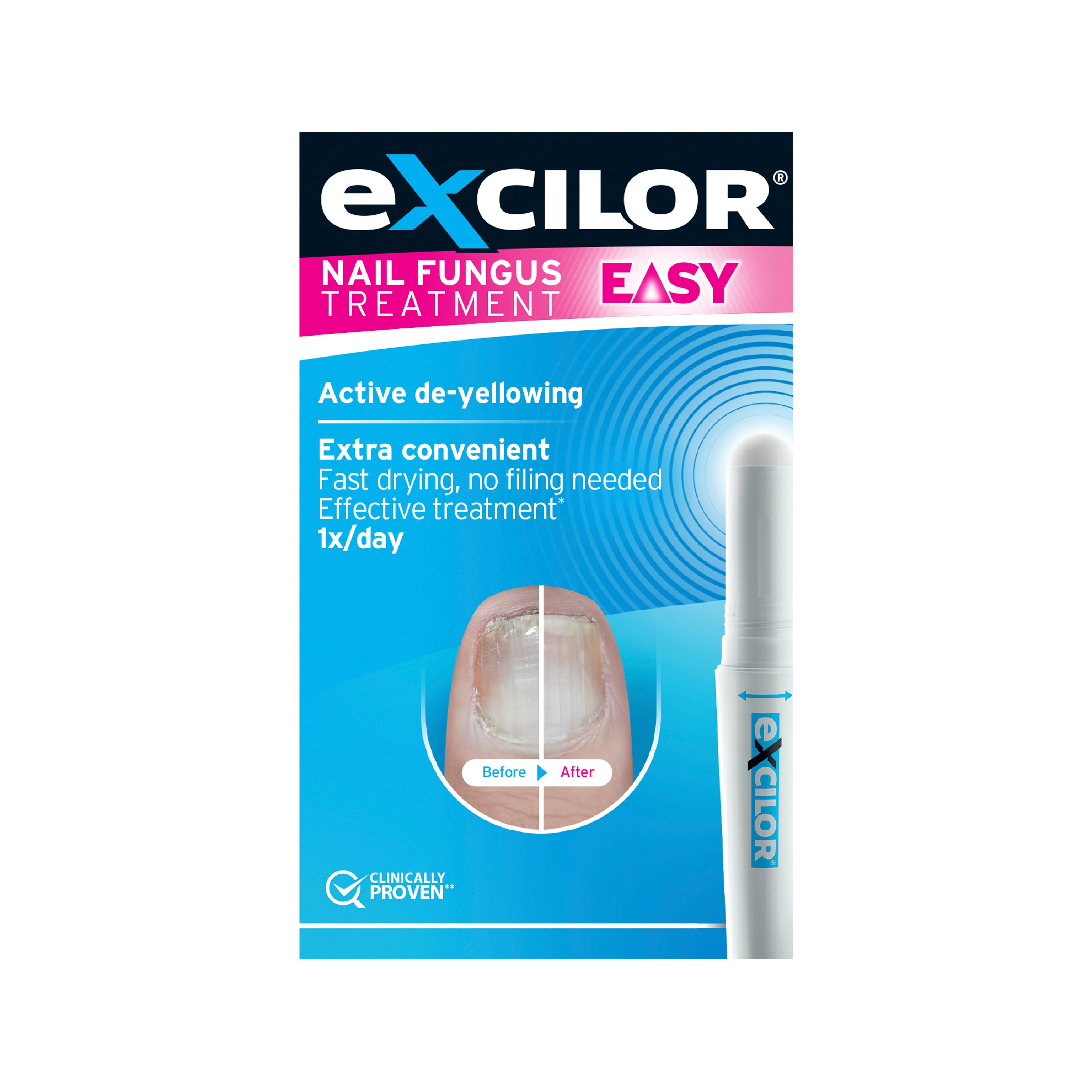 Excilor Nail Fungus Treatment Pen
