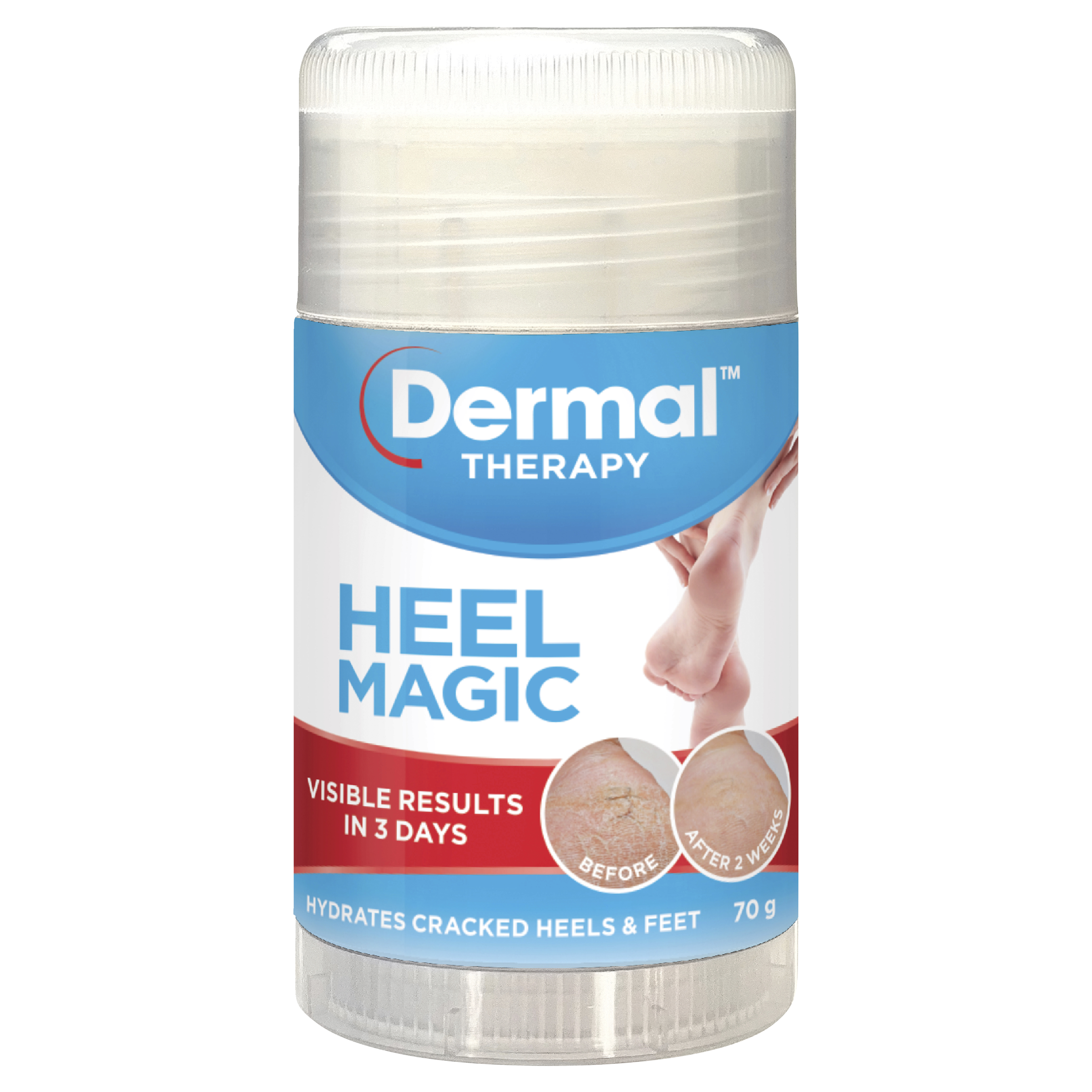 Dermal Therapy Heel Magic